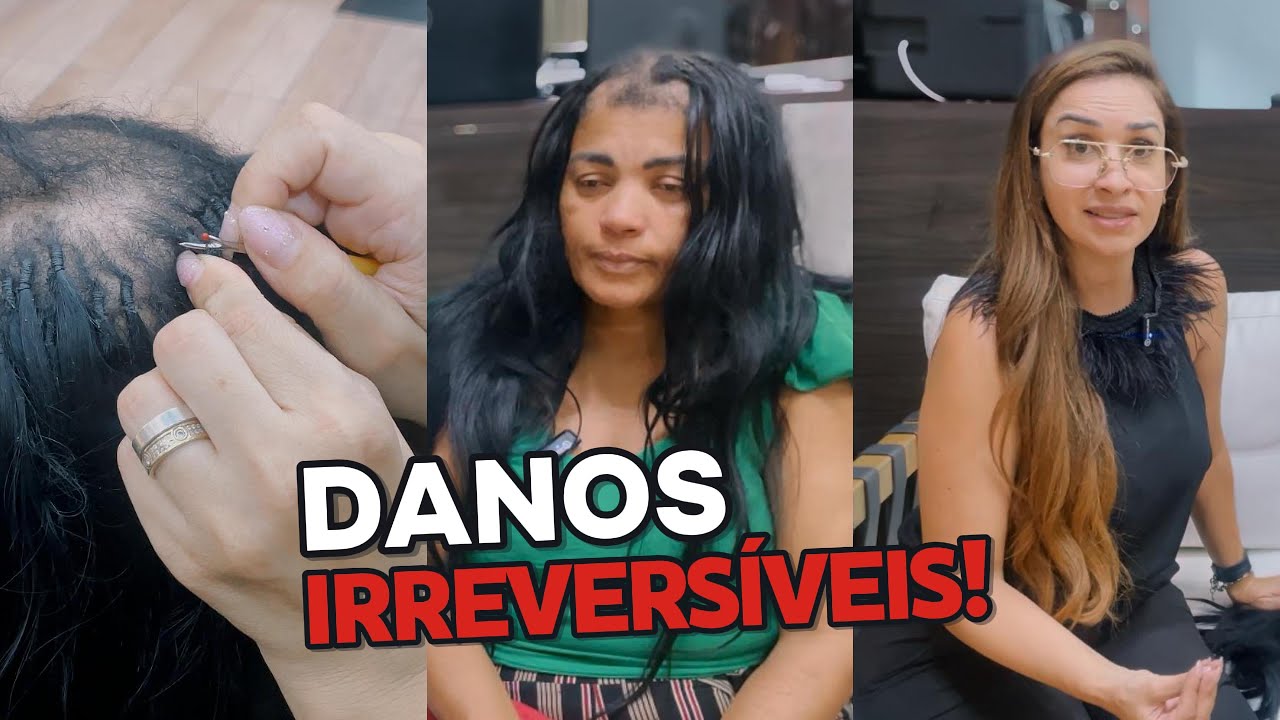 APLIQUE DE TIC TAC E NÓ ITALIANO A CAUSA DE TANTA DOR! - Veja a transformação com o invisível!