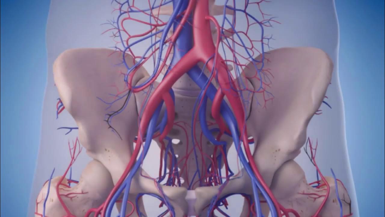 варикозное расширерие вермалого таща. варикоз внутреннего таза. эктазия вен малого таза. варикозное расширение вен таза. варикоз яичниковая вена.