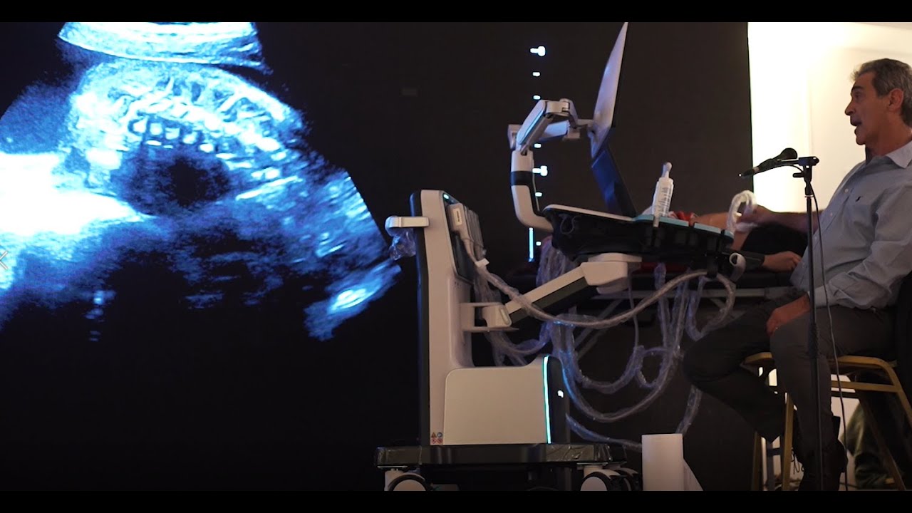 Lanzamiento Mindray Resona I9 en Buenos Aires