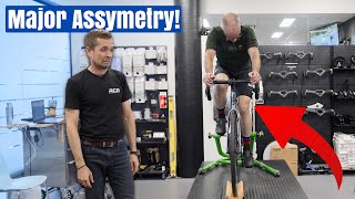 видео: Велосипедная подгонка, которая избавила от 8-летней боли в ногах картинка: Велосипедная подгонка, которая избавила от 8-летней боли в ногах