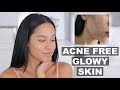 HOW I KEEP MY SKIN CLEAR & ACNE FREE | Marie Jay