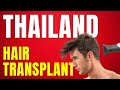 hair transplant in thailand (what you need to know!!) (Copyright Free Content)