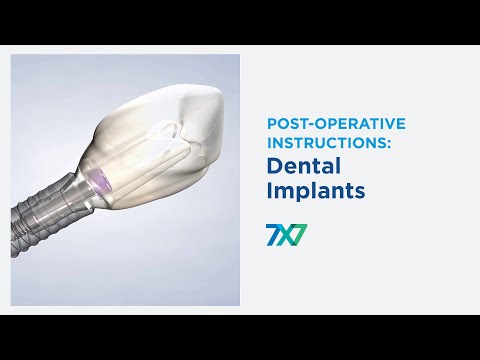 Post-Operative Instructions: Dental Implants | 7x7 Dental Implant & Oral Surgery Specialists