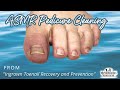 👣ASMR Pedicure Cleaning💆‍♀️Ingrown Toenail Recovery and Prevention👣