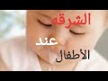 اسباب الشرقه عند طفلك الرضيع وازاي نقلل منها اسباب الشرقه عند طفلك الرضيع وازاي نقلل منها