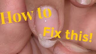 🌟😱HOW TO FIX BROKEN NAILS😱🌟 | COMPILATION |     💜BeaUTy4ReAL💜