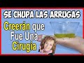 el mejor aceite CHUPA ARRUGAS Y ELIMINADOR DE MANCHAS