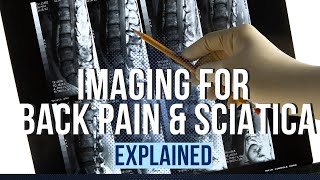 Imaging for Back Pain & Sciatica Explained