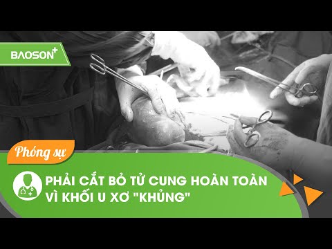 Nữ bệnh nhân 50 tuổi phải cắt bỏ hoàn toàn tử cung và hai phần phụ vì khối u xơ "KHỦNG"