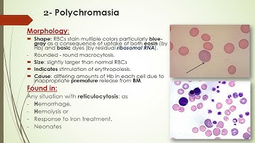 Practical Hematology l14l RBC Morphology-Part-1 [Abnormal Size, Shape, Color, Inclusions, Parasites]