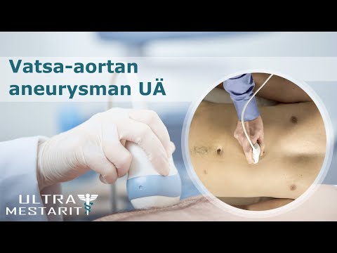 Video: Haurauden Verrattavuus Yleiseen Prognostiikkapisteeseen Potilaiden Tunnistamisessa, Joilla On Riski Huonoista Tuloksista Aortan Venttiilin Vaihdon Jälkeen