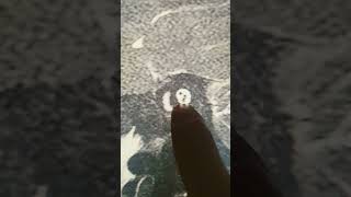 Neuroradiology - Internal Auditory Canal IAC and its component on MRI