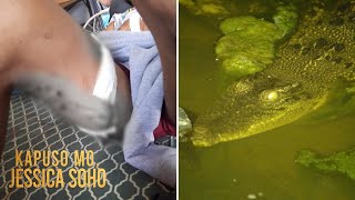 Lalaki mula Tawi-tawi, sinakmal ng buwaya at nagtamo ng 15 sugat! | Kapuso Mo, Jessica Soho