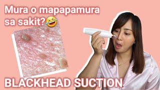 Murang Blackhead Remover Try on and Review