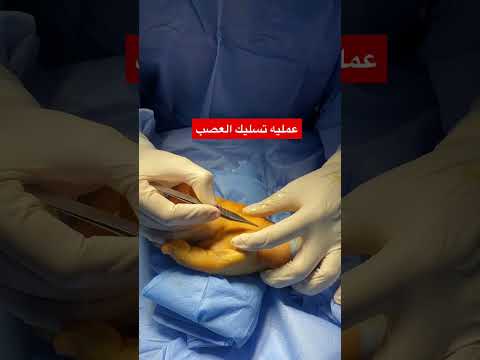 فيديو: ما هي جراحة تجميل الأعصاب؟