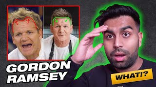 Gordan Ramsey: How He Reversed His Hair Loss