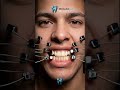 Braces transformation