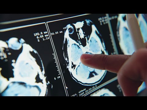 Bachelor of Medicine, Bachelor of Surgery (MBBS) at Hertfordshire Medical School