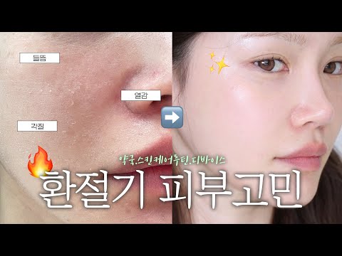 환절기 피부 뒤집어짐🔥바로 회복하는 법!!! 개복치 피부도 일주일만에 꿀피부로 바꿔드림🍯