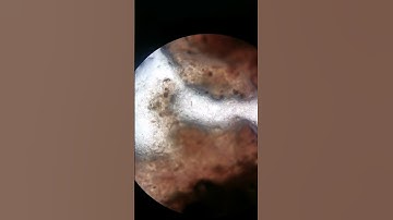 Shrimp paste under the microscope #laboratory #microscope #shrimppaste #bagoong #shrimp