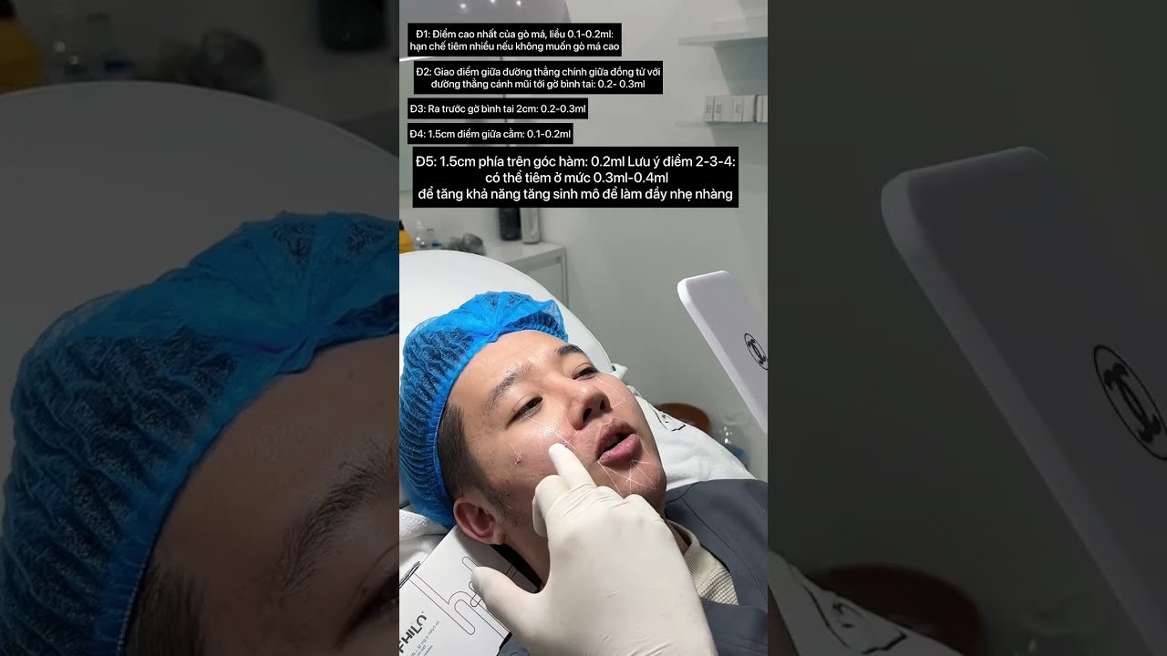 Hướng dẫn thực hành chi tiết BAP Profhilo P2.