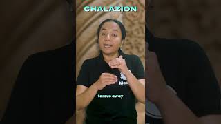 Chalazion Simplified