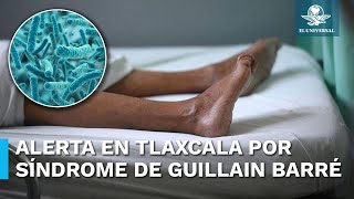 Síndrome que ataca al sistema inmune alerta al Sector Salud en Tlaxcala