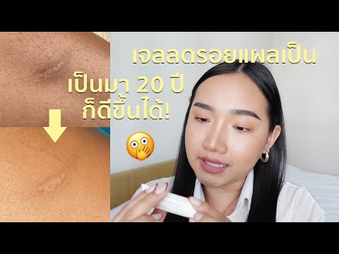 รีวิว + ทดลองใช้เจลลดรอยแผลเป็น 2 สัปดาห์ ผลเกินคาด! | nurseryus