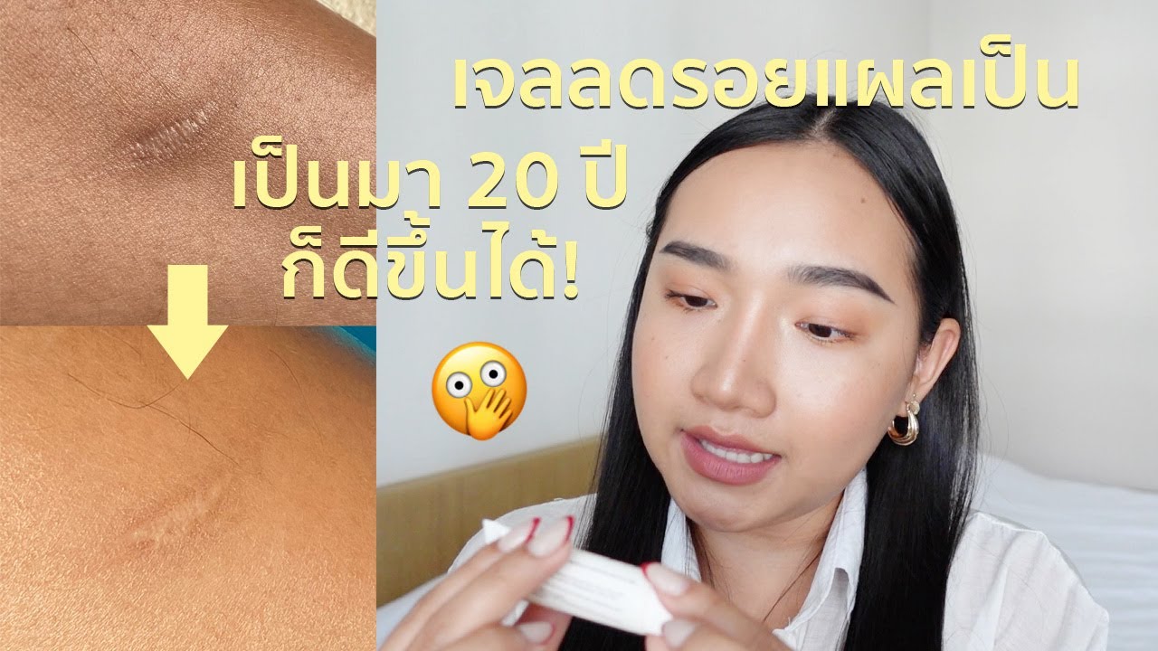 รีวิว + ทดลองใช้เจลลดรอยแผลเป็น 2 สัปดาห์ ผลเกินคาด! | nurseryus