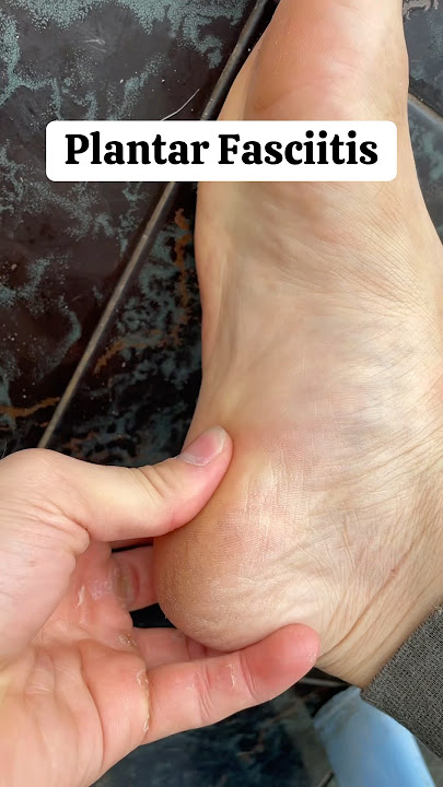 Download lagu Penyebab paling sering sakit tumit 🙈Latihan ini yaa dan jangan lupa konsul dokter