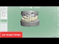 3shape design implant case full arch diagnosis