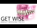 Get Wise About Wisdom Teeth