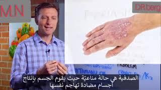 هذا الزيت يساعد في علاج الأكزيما والصدفية