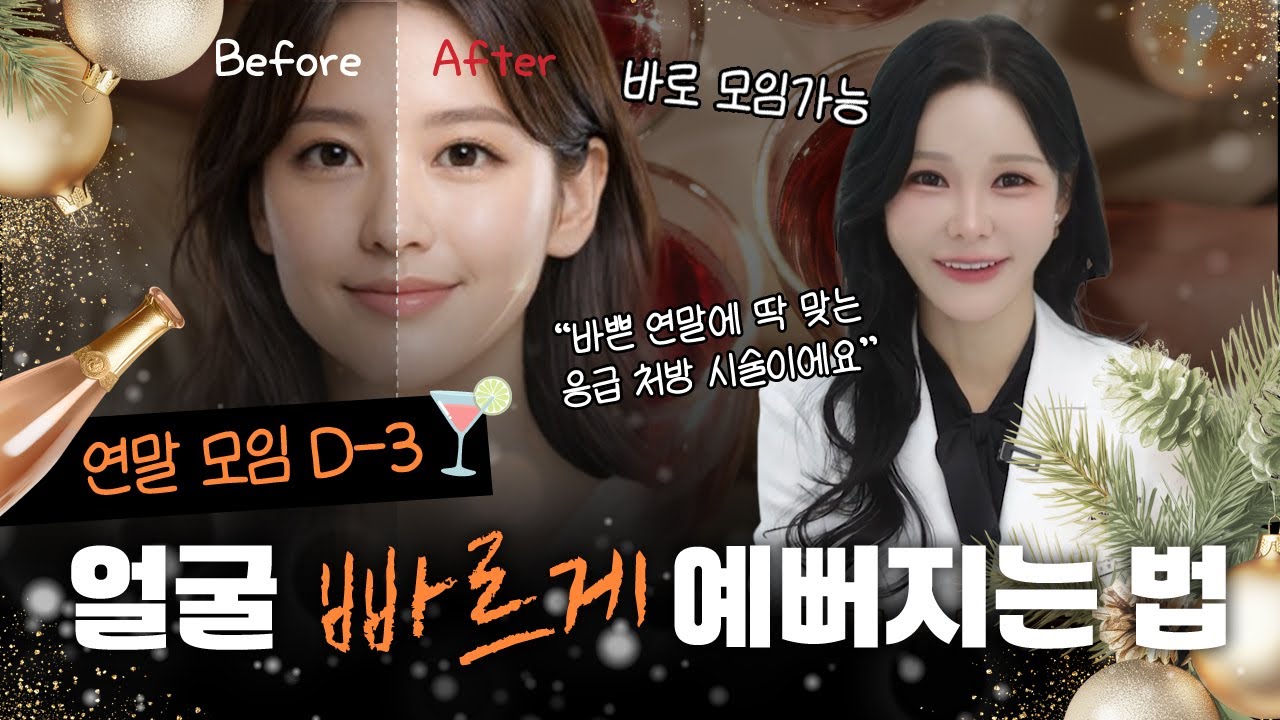 연말 D-7 긴급처방🎄 일주일 만에 얼굴 확 바뀌는 시술 조합 (ft.닥터오블리)