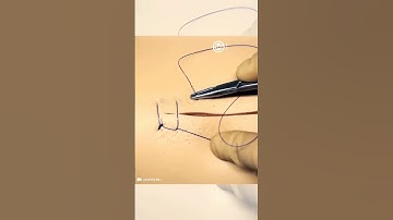 Ford Interlocking (Reverdin - Multanovski - Continuous Lock - Lock Stitch) Suture Pattern