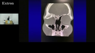 ENT Masterclass Rhinology and allied topics