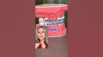 RUBBER BAND PATTERNS EXPLAINED BY AN ORTHODONTIST 🦷 HOW BRACES WORK EXPLANATION