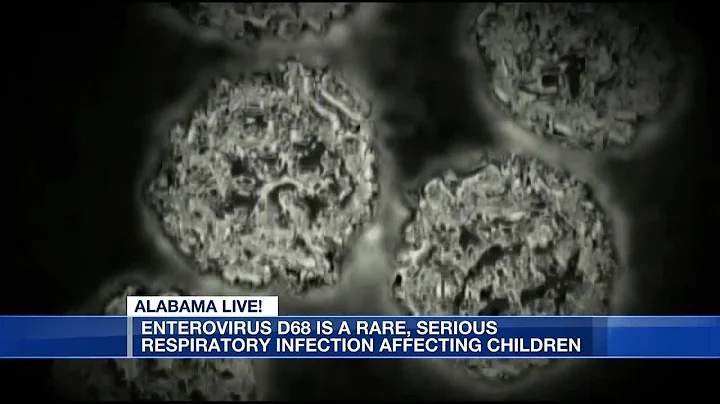 Enterovirus D68 is a rare, serious respiratory infection affecting children