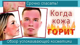 128| SOS-УХОД для ПРОБЛЕМНОЙ КОЖИ | Покраснение лица - как помочь