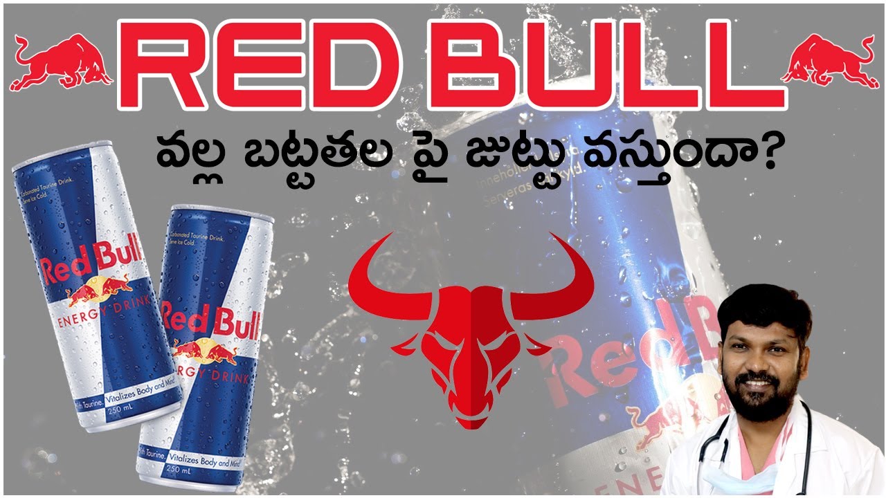  DrJohnWatts Can Red Bull Prevent Hair Loss Best Hair Transplant