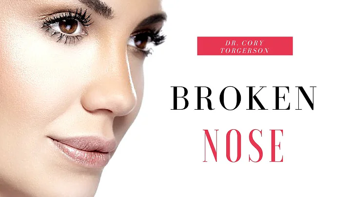 Broken Nose | Dr. Cory Torgerson
