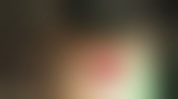 HDH MEDICAL Fem-Pop Bypass August 2011 .mp4