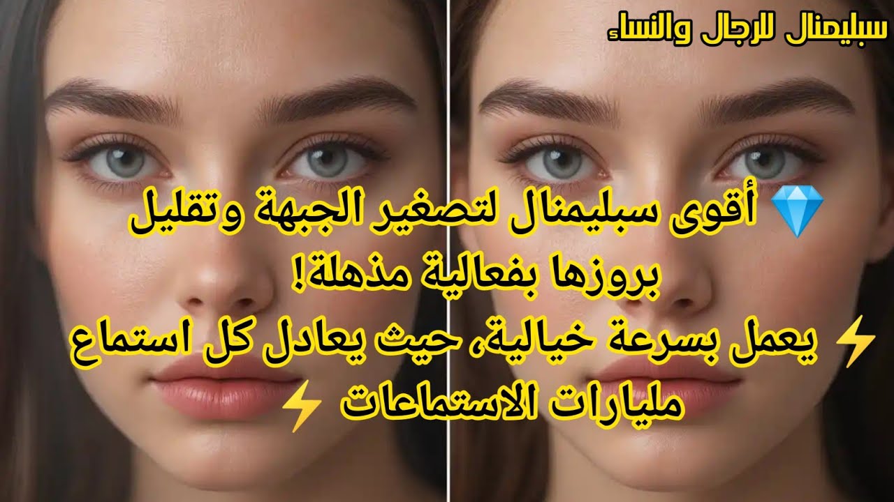 💎 أقوى سبليمنال لتصغير الجبهة وتقليل بروزها بفعالية مذهلة!⚡يعمل بسرعة خيالية،جبهة أصغر|ملامح متناسقة