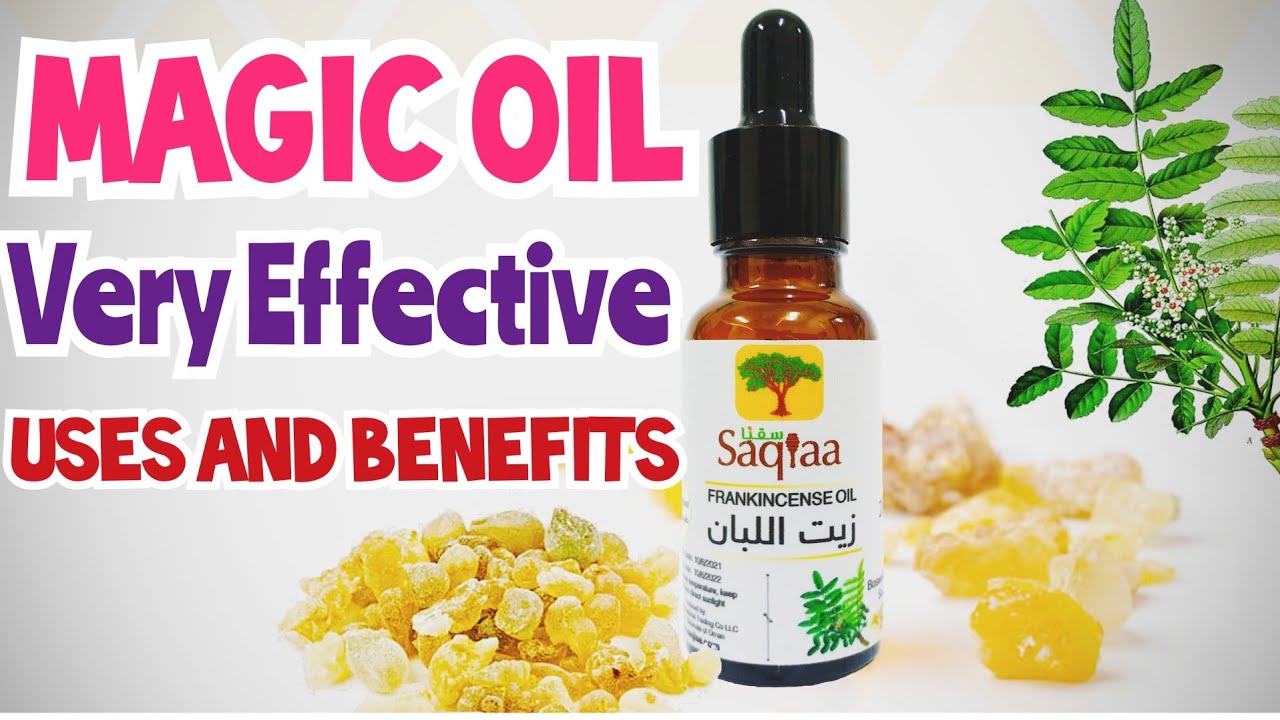 Uses and Benefits of Frankincense oil/How to use Frankincense Essential