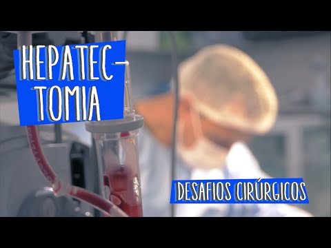 Vídeo: A hepatectomia dói?