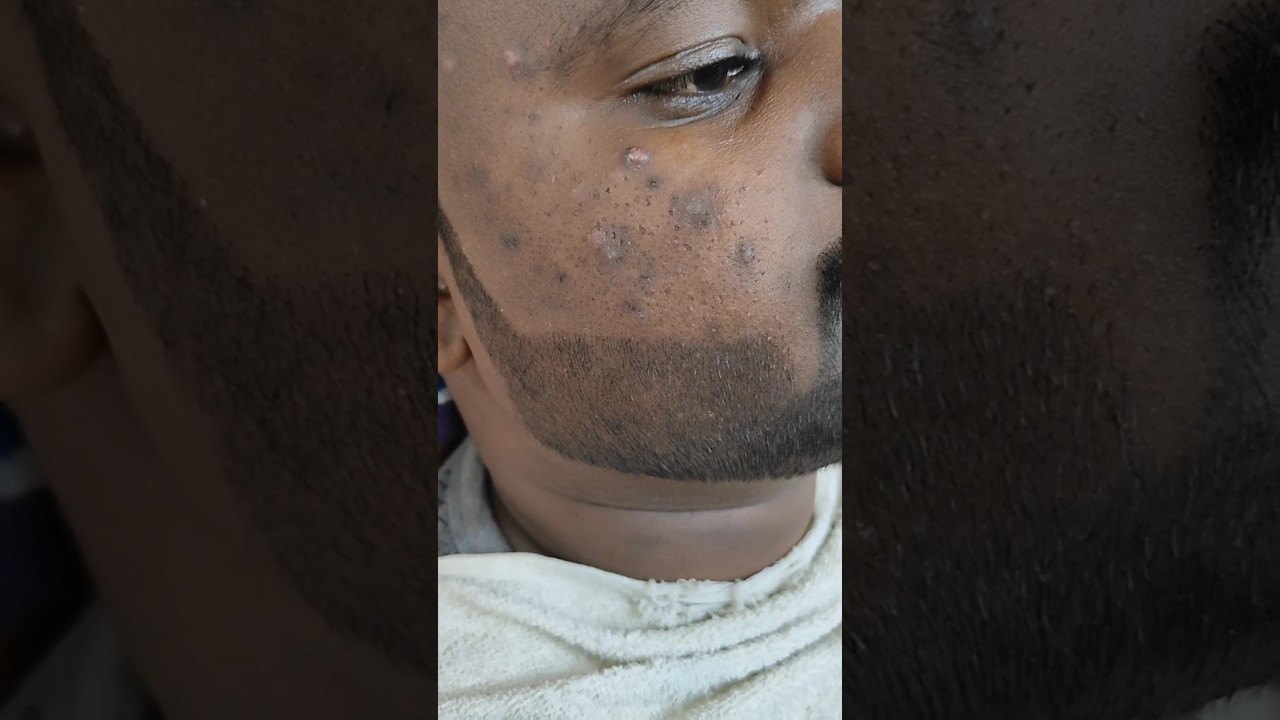 D TAN Pack Face Cleanup 