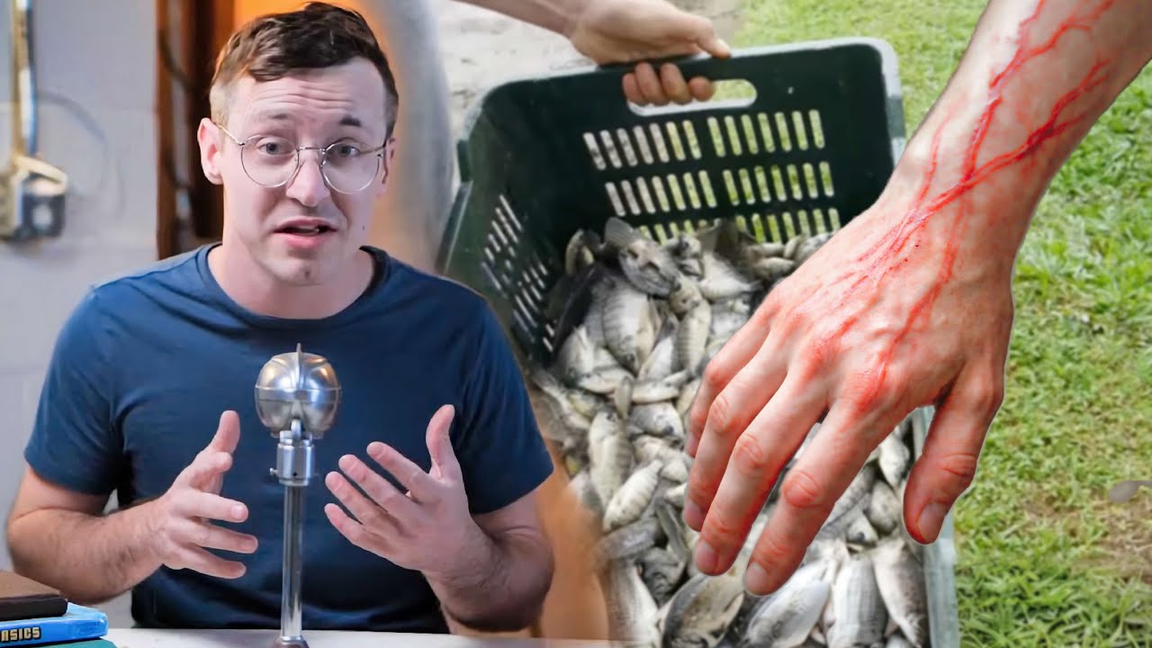 The Worst Fishing Injuries I've Ever Had : Fishing Stories - YouTube