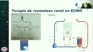 Técnicas de TRR en ECMO.