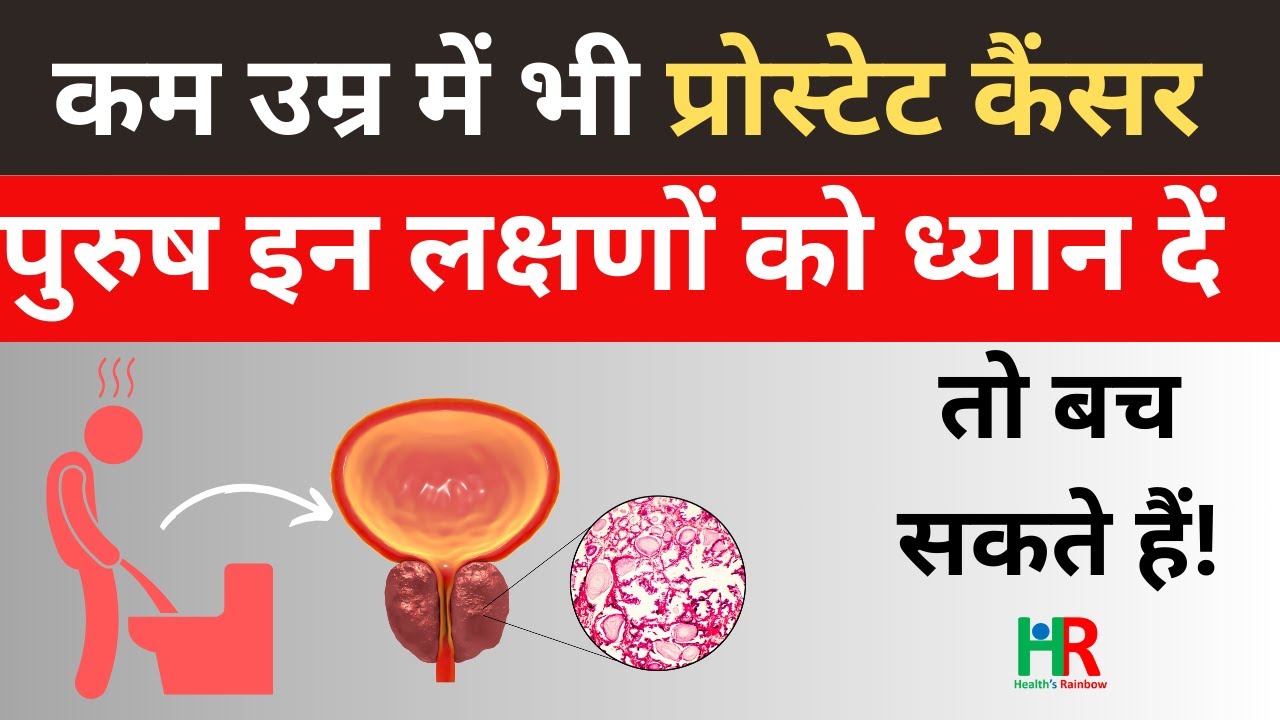 Prostate cancer ke lakshan गदूद कैंसर prostate cancer ka ilaj kya