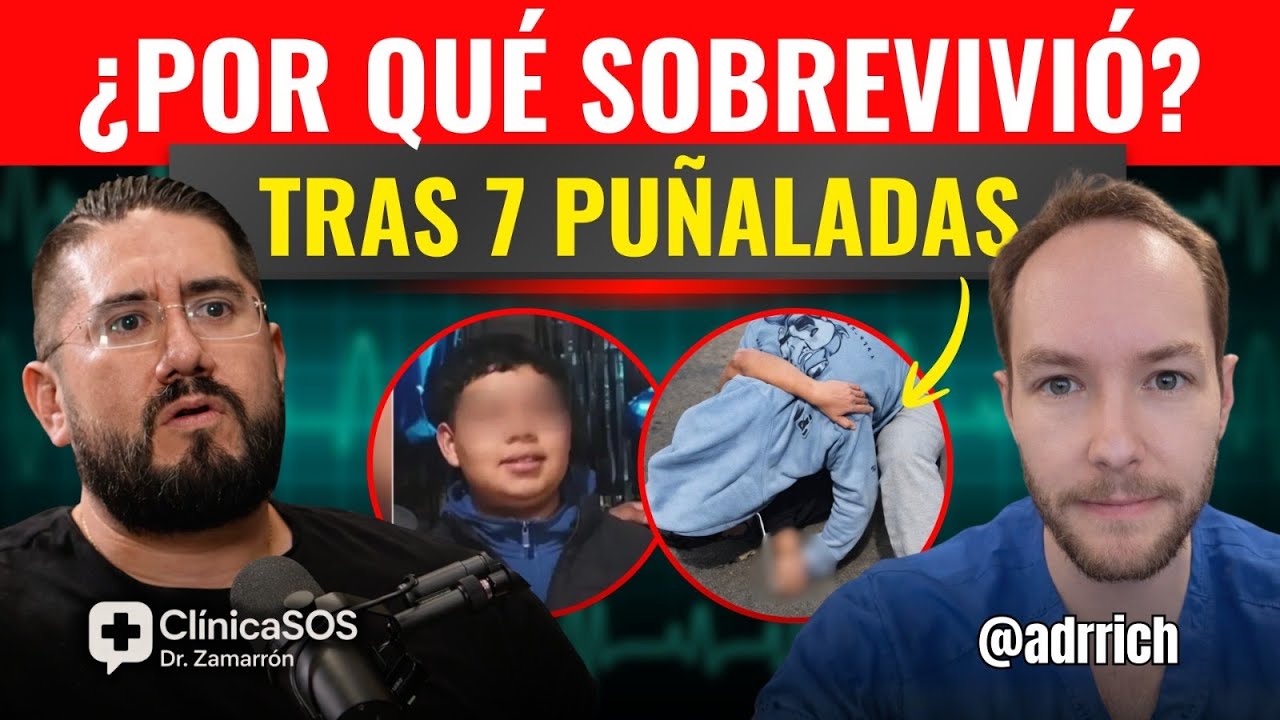 🚨 Caso Jeremy: De una RIÑA ESCOLAR a Terapia Intensiva | Qué revelan las heridas